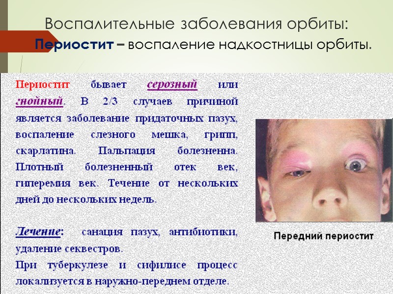 Воспалительные заболевания орбиты: Периостит – воспаление надкостницы орбиты.